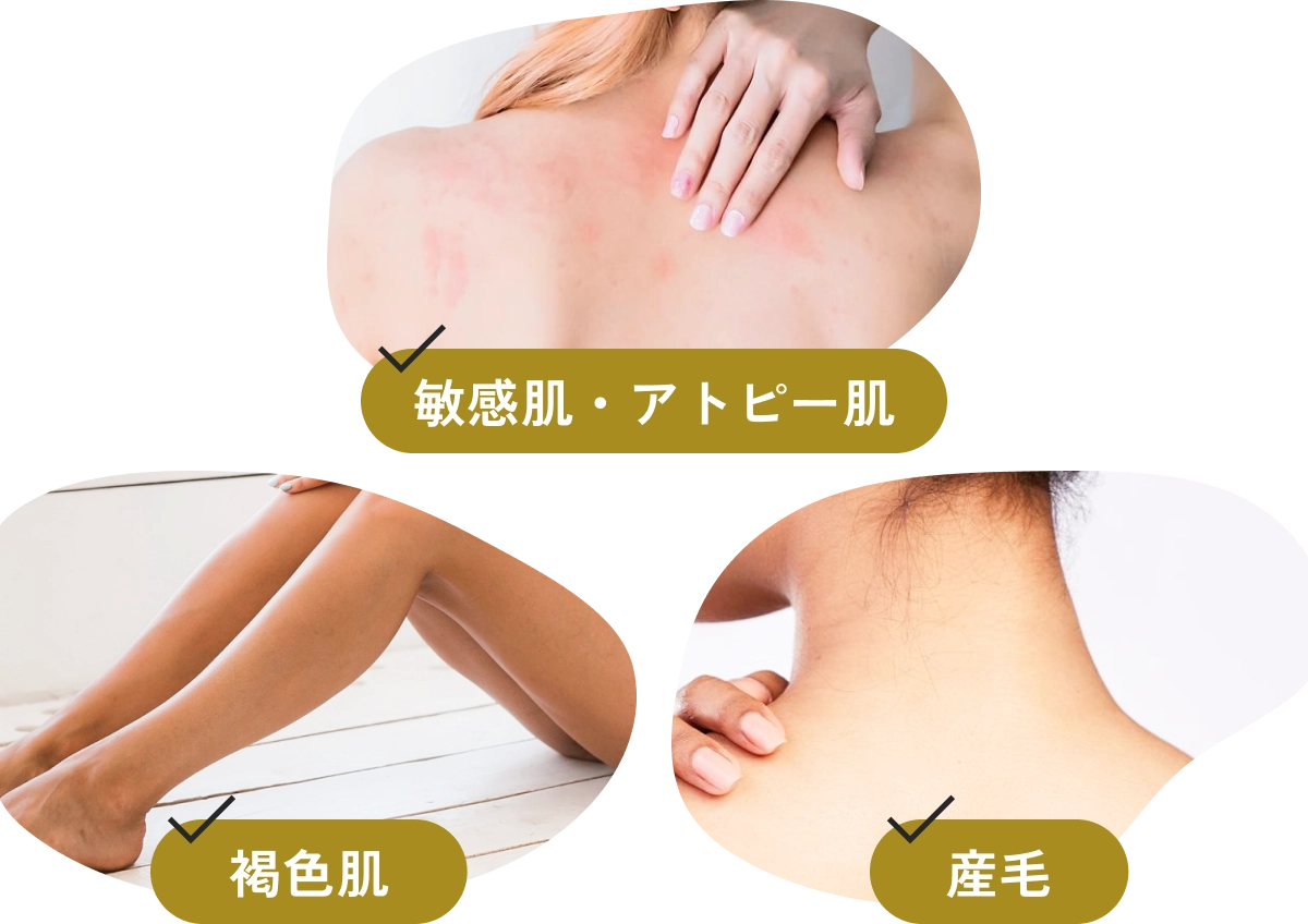 敏感肌・アトピー肌、褐色肌、産毛