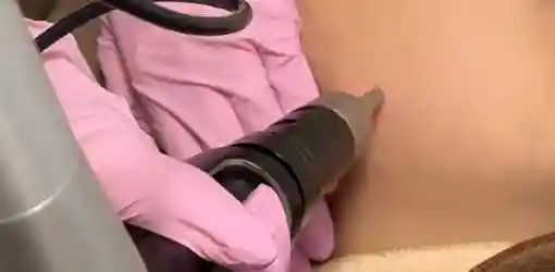 照射のイメージ