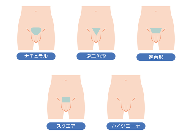 男性（メンズ）VIO脱毛のデザイン