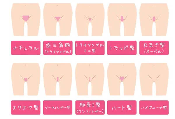 VIO医療脱毛の人気デザイン