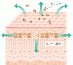 シミ取りレーザー仕組み