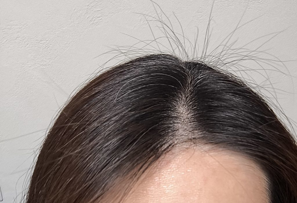 b.ris veil使用後（3回目）