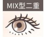 NIX型二重