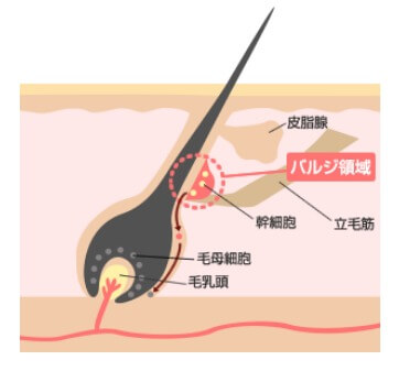 熱破壊式と蓄熱式