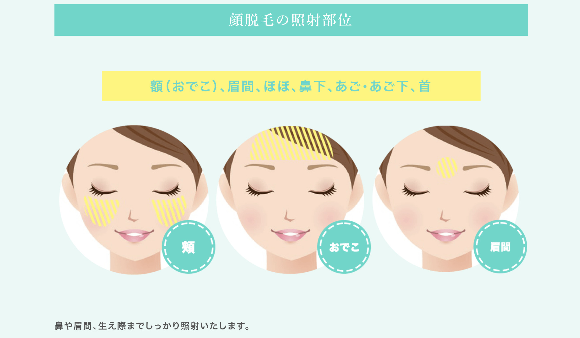 カレイドクリニックの顔脱毛